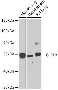 Western blot analysis of extracts of various cell lines using DSG2 Polyclonal Antibody at dilution of 1:1000.