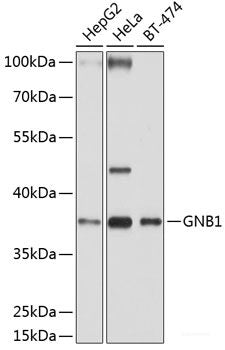 Immunohistochemistry of paraffin-embedded Rat spinal cord using ADRBK2 Polyclonal Antibody at dilution of 1:100 (40x lens).