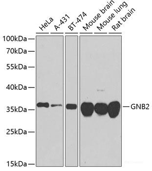 Western blot analysis of extracts of Mouse testis using CD320 Polyclonal Antibody at dilution of 1:1000.
