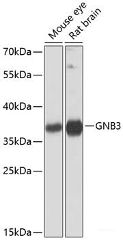 Immunofluorescence analysis of MCF-7 cells using RNF8 Polyclonal Antibody