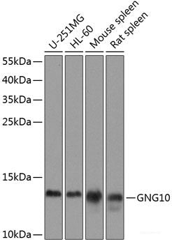 Western blot analysis of extracts of various cell lines using DDX50 Polyclonal Antibody at dilution of 1:3000.