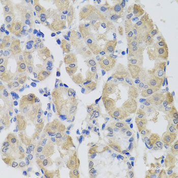 Immunohistochemistry of paraffin-embedded Rat brain using TTR Polyclonal Antibody at dilution of 1:100 (40x lens).