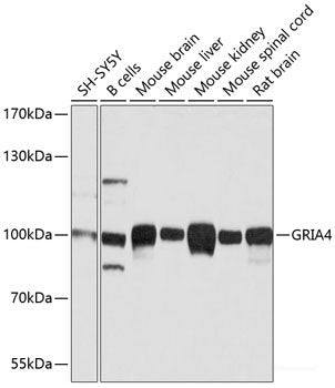 Western blot analysis of extracts of U-87MG cells using TCF25 Polyclonal Antibody at dilution of 1:1000.