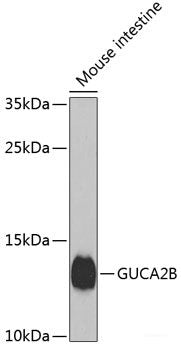 Immunohistochemistry of paraffin-embedded Human prostate using HERC3 Polyclonal Antibody at dilution of 1:100 (40x lens).