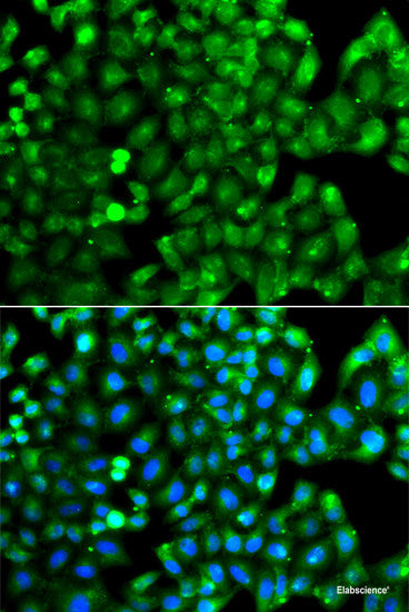 Western blot analysis of extracts of Mouse testis using TSSK4 Polyclonal Antibody at dilution of 1:1000.