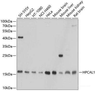 Immunofluorescence analysis of HeLa cells using ADAM10 Polyclonal Antibody at dilution of 1:100. Blue: DAPI for nuclear staining.