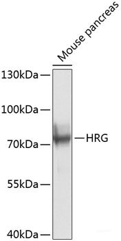 Western blot analysis of extracts of various cell lines using EIF3J Polyclonal Antibody at dilution of 1:3000.