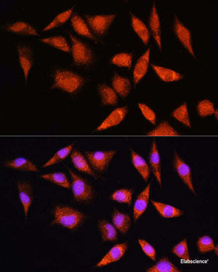 Immunofluorescence analysis of U2OS cells using ARF3 Polyclonal Antibody at dilution of 1:100. Blue: DAPI for nuclear staining.