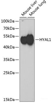 Immunofluorescence analysis of U2OS cells using TNP2 Polyclonal Antibody