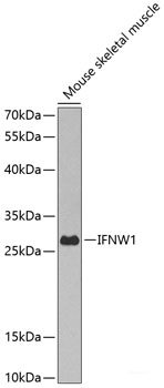 Immunohistochemistry of paraffin-embedded Rat liver using RNF5 Polyclonal Antibody at dilution of 1:100 (40x lens).