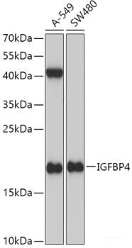 Western blot analysis of extracts of various cell lines using NR3C1 Polyclonal Antibody at dilution of 1:1000.