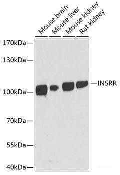 Western blot analysis of extracts of SW480 cells using SMAD7 Polyclonal Antibody at dilution of 1:1000.