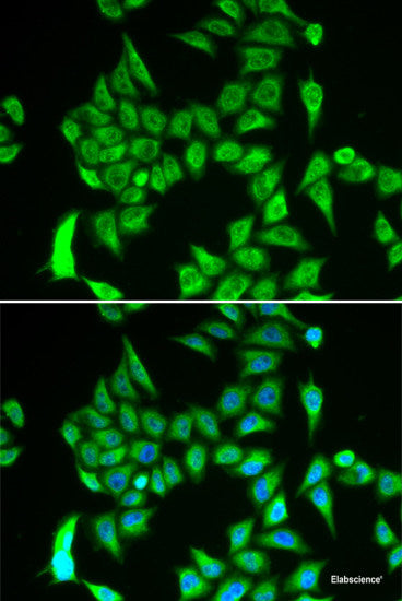 Immunohistochemistry of paraffin-embedded Mouse skin using CALU Polyclonal Antibody at dilution of 1:100 (40x lens).
