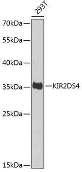 Immunofluorescence analysis of U2OS cells using BST2 Polyclonal Antibody at dilution of 1:100. Blue: DAPI for nuclear staining.