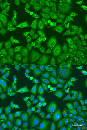 Immunofluorescence analysis of U2OS cells using ENTPD5 Polyclonal Antibody at dilution of 1:100. Blue: DAPI for nuclear staining.