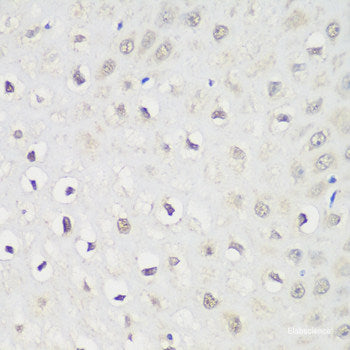 Immunohistochemistry of paraffin-embedded Rat brain using MTIF3 Polyclonal Antibody at dilution of 1:100 (40x lens).