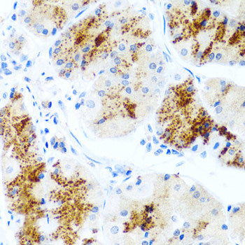 Immunohistochemistry of paraffin-embedded Rat brain using RPN2 Polyclonal Antibody at dilution of 1:100 (40x lens).