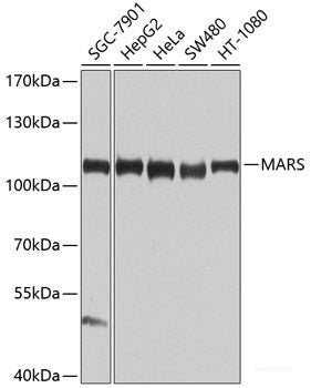Western blot analysis of extracts from 293 cells using Phospho-ACACA(S79) Polyclonal Antibody.