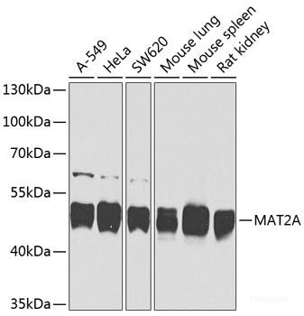 Western blot analysis of extracts of various cell lines using MTHFD1 Polyclonal Antibody at dilution of 1:1000.