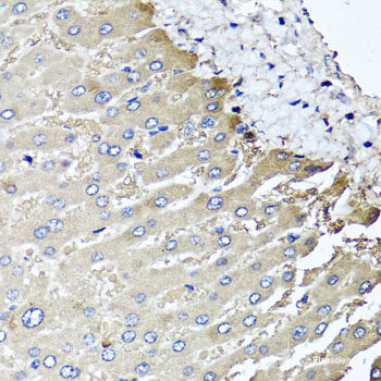 Immunofluorescence analysis of MCF7 cells using Caspase-14 Polyclonal Antibody