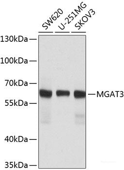 Immunofluorescence analysis of Rat oophoroma cells using ZP3 Polyclonal Antibody at dilution of 1:100. Blue: DAPI for nuclear staining.