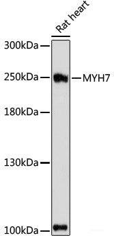 Immunohistochemistry of paraffin-embedded Rat heart using PDE4DIP Polyclonal Antibody at dilution of 1:100 (40x lens).