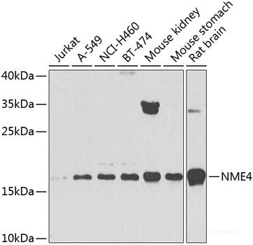 Immunohistochemistry of paraffin-embedded Mouse heart using PIK3C2A Polyclonal Antibody at dilution of 1:100 (40x lens).