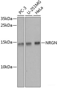 Immunohistochemistry of paraffin-embedded Rat ovary using NMT1 Polyclonal Antibody at dilution of 1:100 (40x lens).
