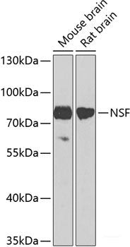 Western blot analysis of extracts of RAW264. 7 cells using GADD45G Polyclonal Antibody at dilution of 1:1000.