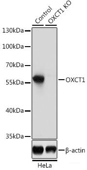 Immunohistochemistry of paraffin-embedded Human liver using PPP4R1 Polyclonal Antibody at dilution of 1:100 (40x lens).