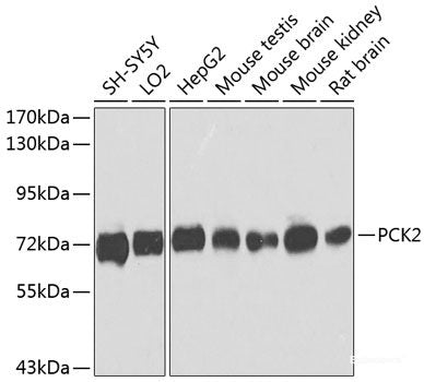 Western blot analysis of extracts of various cell lines using GTF2E2 Polyclonal Antibody at dilution of 1:1000.