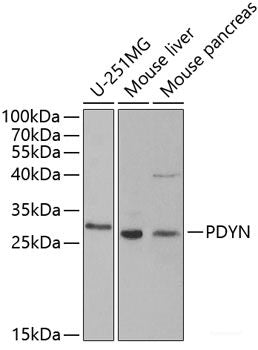 Western blot analysis of extracts of various cell lines using SETDB1 Polyclonal Antibody at dilution of 1:1000.
