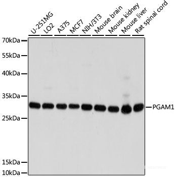 Western blot analysis of extracts of various cell lines using LPCAT2 Polyclonal Antibody at dilution of 1:3000.