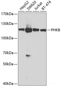 Immunofluorescence analysis of U2OS cells using NLRP2 Polyclonal Antibody at dilution of 1:100. Blue: DAPI for nuclear staining.