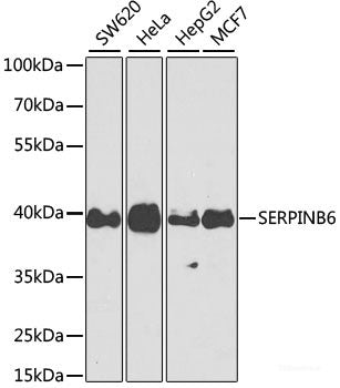 Western blot analysis of extracts of HeLa cells using Phospho-CDK1(T161) Polyclonal Antibody at dilution of 1:1000.