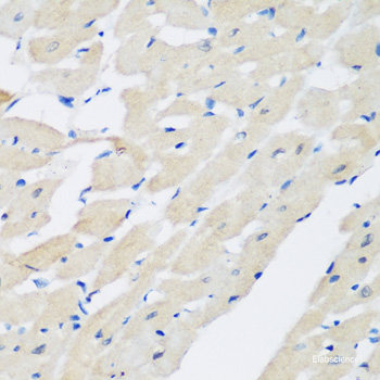 Western blot analysis of extracts of various cell lines using HAO1 Polyclonal Antibody at dilution of 1:500.