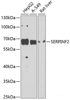 Western blot analysis of extracts from HeLa cells using Phospho-CDK2(T160) Polyclonal Antibody.