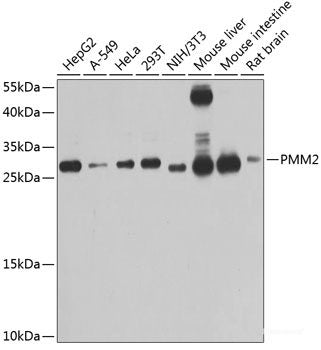 Western blot analysis of extracts of various cell lines using PIDD Polyclonal Antibody at dilution of 1:1000.