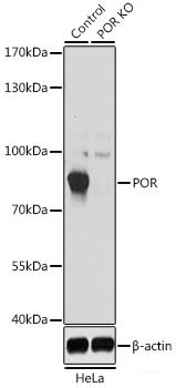 Western blot analysis of extracts of various cell lines using NUDT15 Polyclonal Antibody at dilution of 1:1000.