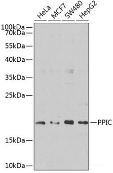 Immunofluorescence analysis of U2OS cells using Phospho-Btk(Y223) Polyclonal Antibody