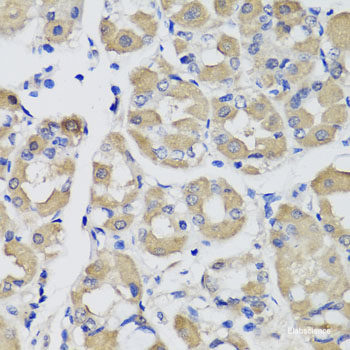 Western blot analysis of extracts of Mouse skeletal muscle using IFNW1 Polyclonal Antibody at dilution of 1:1000.