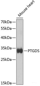Immunohistochemistry of paraffin-embedded Rat liver using IKK alpha Polyclonal Antibody at dilution of 1:100 (40x lens).