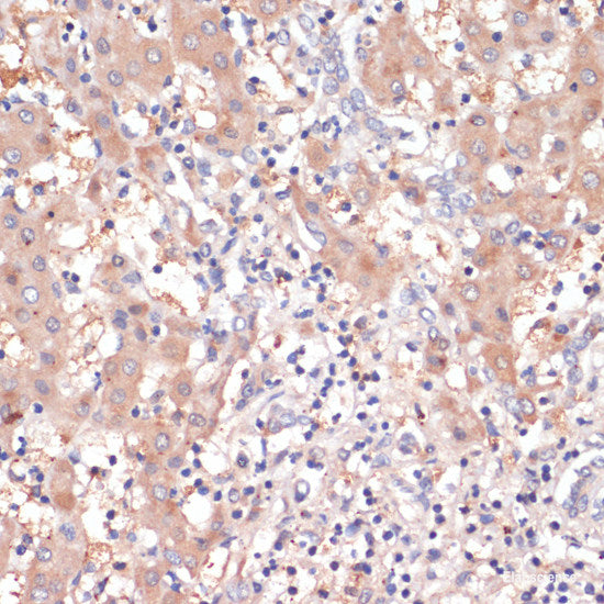 Immunofluorescence analysis of HeLa cells using CDK11B Polyclonal Antibody at dilution of 1:100. Blue: DAPI for nuclear staining.