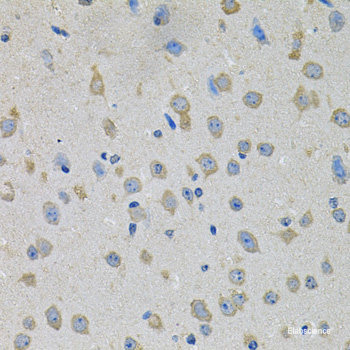 Immunohistochemistry of paraffin-embedded Rat lung using Phospho-STAT1(S727) Polyclonal Antibody at dilution of 1:100 (40x lens).