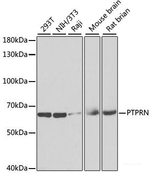 Immunohistochemistry of paraffin-embedded Rat testis using CIRBP Polyclonal Antibody at dilution of 1:100 (40x lens).