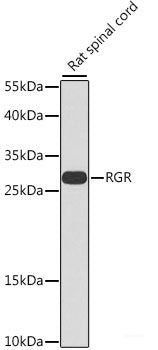 Immunohistochemistry of paraffin-embedded Human stomach using LAMB3 Polyclonal Antibody at dilution of 1:100 (40x lens).