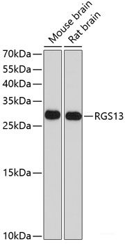 Western blot analysis of extracts of Mouse brain using TREM2 Polyclonal Antibody at dilution of 1:1000.