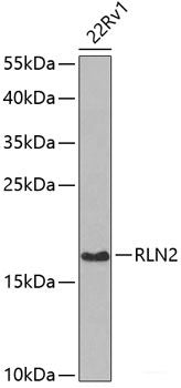 Immunohistochemistry of paraffin-embedded Rat brain using METTL13 Polyclonal Antibody at dilution of 1:100 (40x lens).