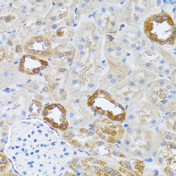 Western blot analysis of extracts of C2C12 cells using Phospho-PRKAA1(T183)/PRKAA2(T172) Polyclonal Antibody at dilution of 1:2000. C2C12 cells were treated by Oligomycin (0. 5uM) for 30 minutes, treated by serum-starvation overnight, treated by Hydrogen Peroxide (2nM) for 15 minutes or treated by AICAR (0. 5mM) for 30 minutes after serum-starvation overnight.