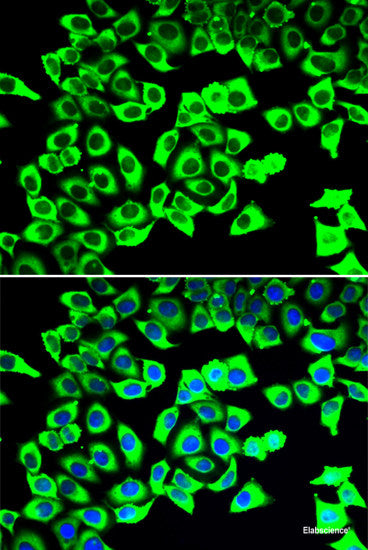 Western blot analysis of extracts of Mouse liver using TXNL4B Polyclonal Antibody at dilution of 1:1000.